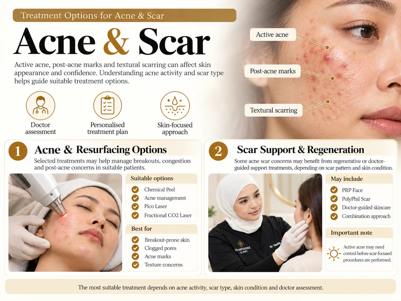 Acne & Scarring — treatment options and doctor assessment at a glance
